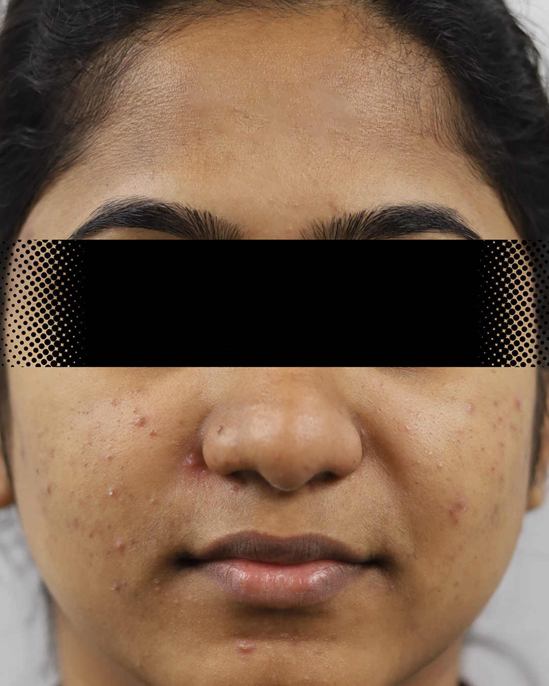 Before treatment