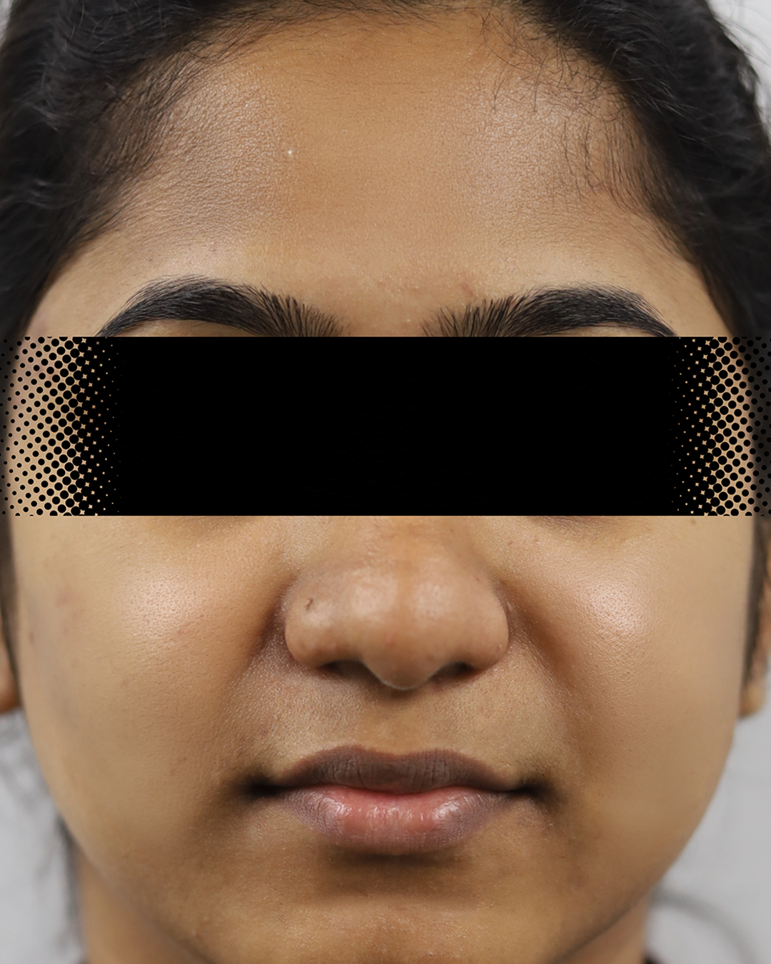 After treatment